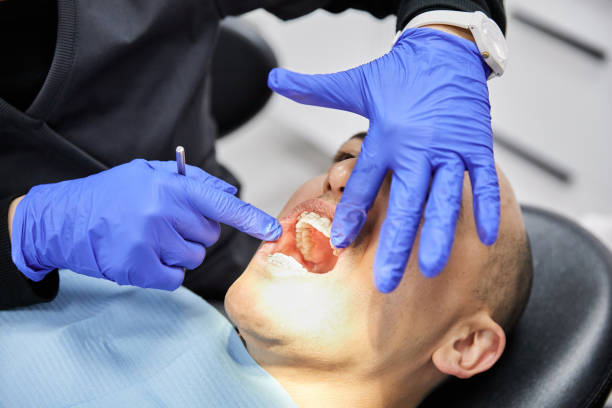 Best Emergency Dental Care for Sports Injuries in Fairview, GA